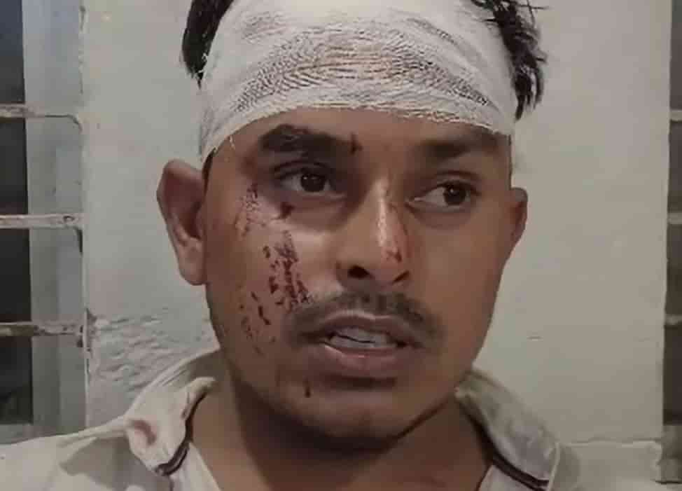 जमशेदपुर के परसुडीह थाना क्षेत्र में संतोष कुमार नाम के युवक पर जानलेवा हमला हुआ है. मामले की पुलिस जांच कर रही है।
